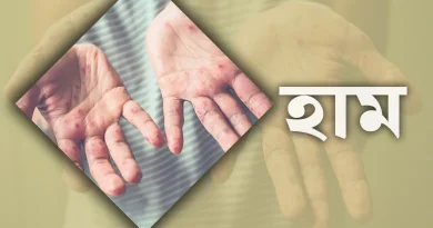 হাম উপসর্গে একদিনে আরও ৫ জনের মৃত্যু
