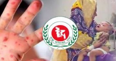 হামের উপসর্গে আরও ৪ জনের মৃত্যু, মোট মৃত্যু ৯২২ জন